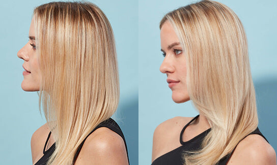before and after of blonde woman 